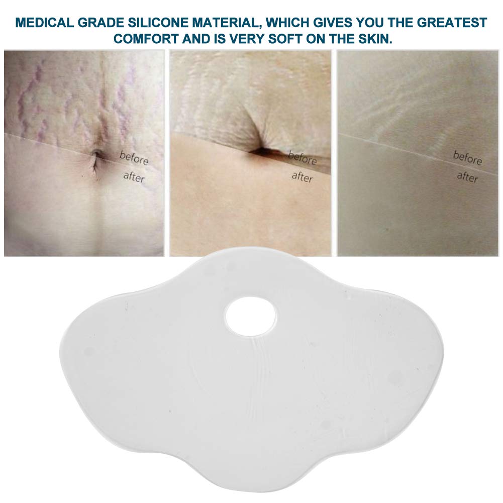Reusable Silicone Anti-Wrinkle Belly Scar stickers Stomach Pads cover Stickers Stretch Marks Removal Skin Care