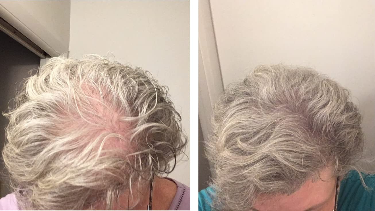 Caboki Hair Loss Concealer. All-Natural Hair Building Fiber. Make Thin Hair Look 10X Fuller Instantly. Eliminate the Appearance of Bald Spot and Thinning Hair (30G, 90-Day Supply). Gray