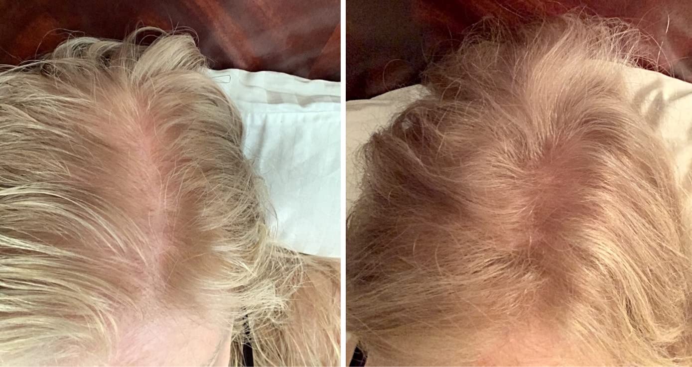 Caboki Hair Loss Concealer. All-Natural Hair Building Fiber. Make Thin Hair Look 10X Fuller Instantly. Eliminate the Appearance of Bald Spot and Thinning Hair (30G, 90-Day Supply). Golden Blonde