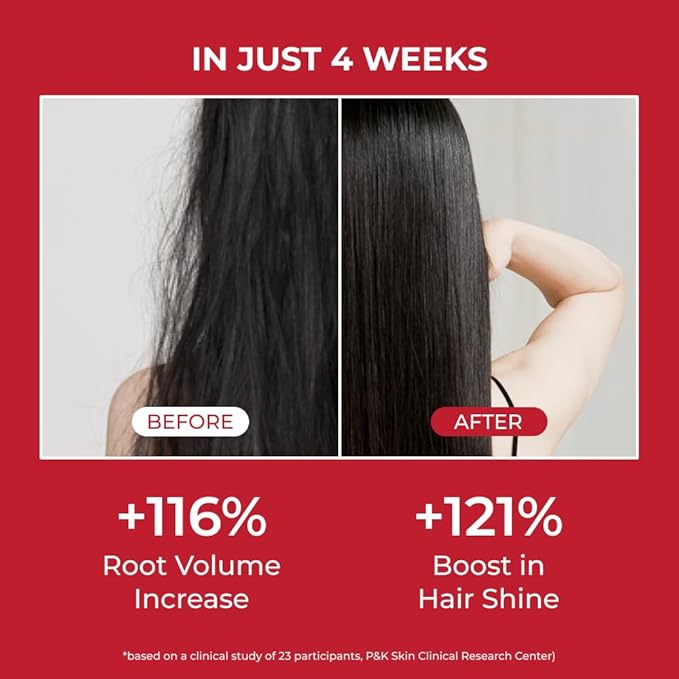 MOEV ANNURCATIN Shampoo | Korean Apple Hair Care for Strength and Volume in Thinning Hair | Adds Lift | Paraben-Free | Suitable for All Hair Types (17.75 fl.oz, Apple & Vanilla)