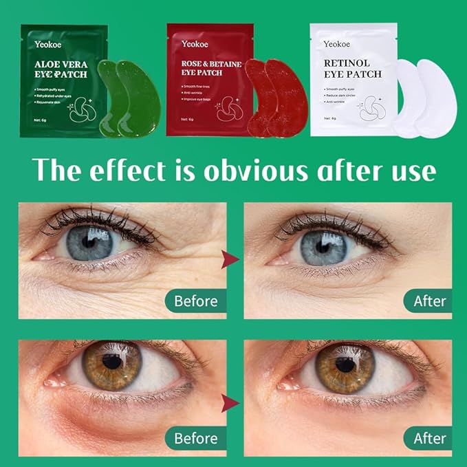 Under Eye Patches For Puffy Eyes and Dark Circles Wrinkle,30 Pairs Face Masks SkinCare With Retinol Serum,Aloe Vera,Rose Betaine
