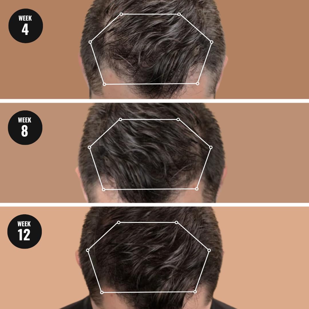 Mane Root Activator & Hair Growth Conditioner for Men (250ml) - Thickening Conditioner for Stronger Follicles, Healthy Roots & Scalp - Volumize, Full & Thicker Hair for Men