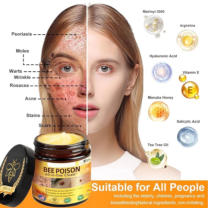 Bee Poison All-in-One Cream,New Professional Bee Venom Skin Treatment Cream, Repair, Moisturize and lift 3 in 1, for All skin Types. (1)