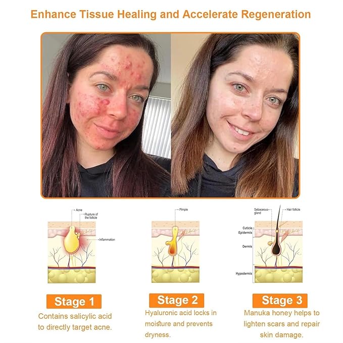 Bee Poison All-in-One Cream,New Professional Bee Venom Skin Treatment Cream, Repair, Moisturize and lift 3 in 1, for All skin Types. (1)