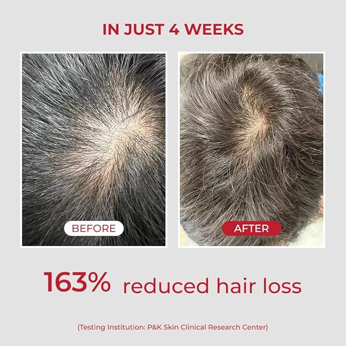 MOEV ANNURCATIN Shampoo | Korean Apple Hair Care for Strength and Volume in Thinning Hair | Adds Lift | Paraben-Free | Suitable for All Hair Types (17.75 fl.oz, Apple & Vanilla)