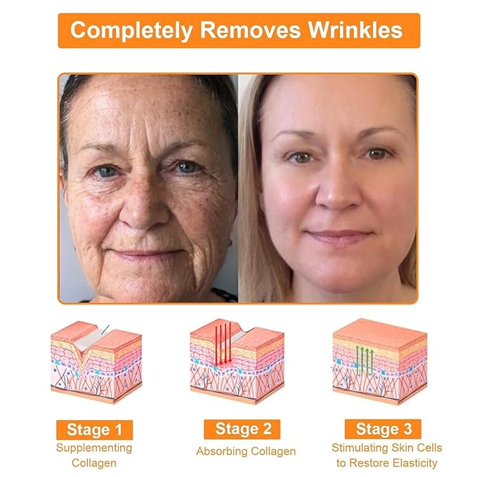 Bee Poison All-in-One Cream,New Professional Bee Venom Skin Treatment Cream, Repair, Moisturize and lift 3 in 1, for All skin Types. (1)